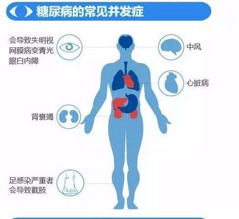 你造嗎？糖尿病晚期眼睛會(huì)致盲！