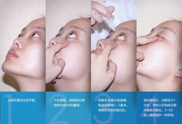 眼藥水你點(diǎn)對(duì)了嗎？快來(lái)看看！