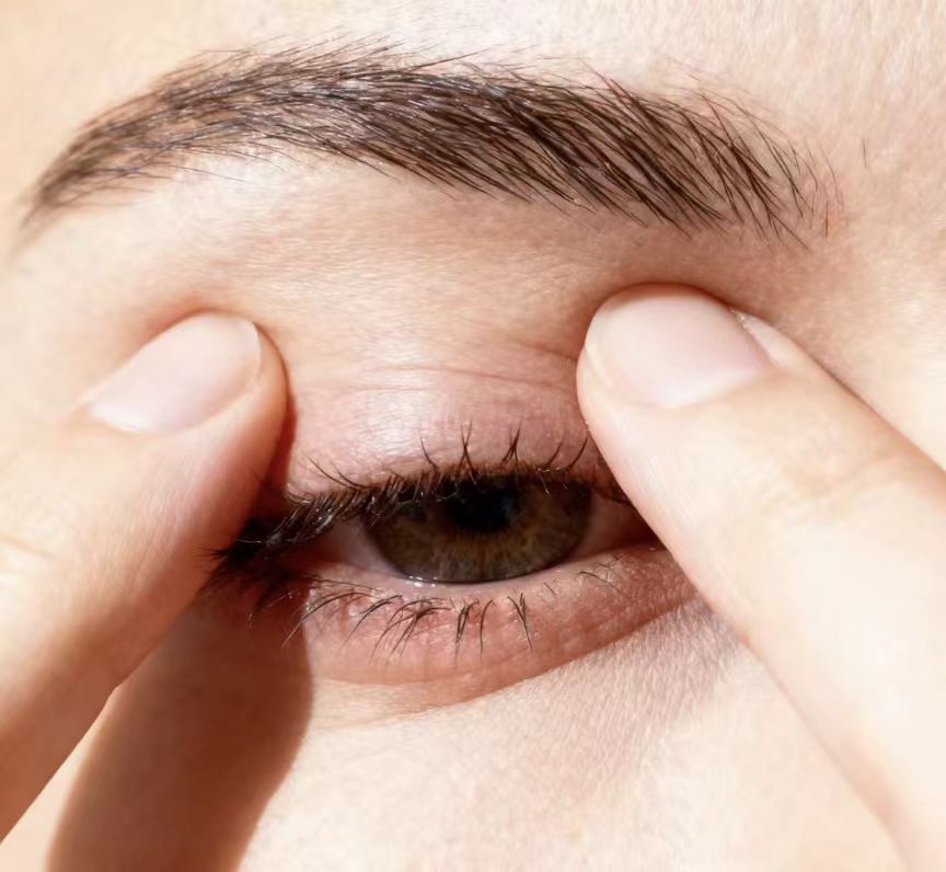 冬季干眼高發(fā)，久治不愈或是睫毛上的螨蟲在作祟！